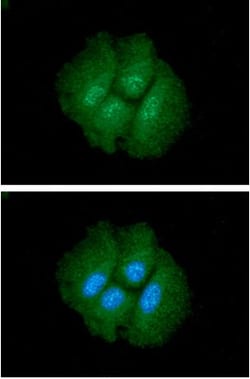 CTGF/CCN2 Mouse anti-Human, Clone: 180000000, Novus Biologicals 50uL; Unlabeled:Antibodies,